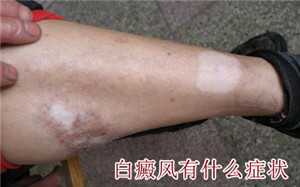 ��������֢״����Щ