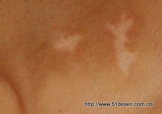 ��������Ȩ��ҽԺ