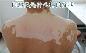 �����֢״����Щ