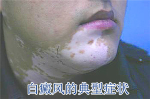 �沿�����֢״����Щ