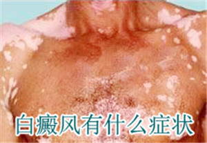 ������ʲô֢״