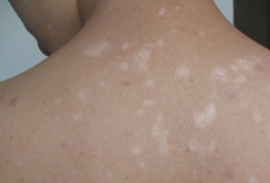 ������õ����Ʒ���