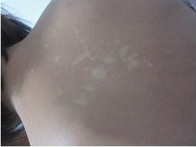 ���������ʲô֢״