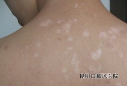 �����֢״��ʲô