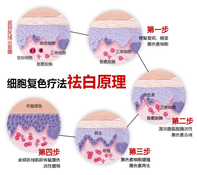 “细胞复色”铸传奇 治白先锋在昆明
