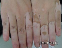 缲Щ