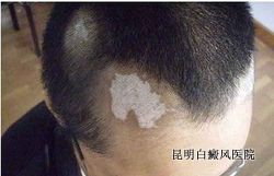 �����֢״��������Щ