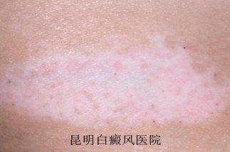 °×ñ°·çΪʲô»áÑ÷