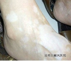 ���������֢״����Щ