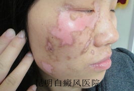 �沿������ô���