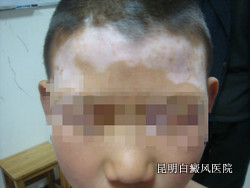 �沿����������