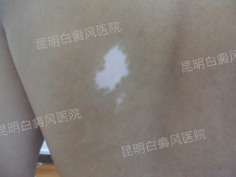 �ᶨ�ֹ��¸ң�սʤ�װ߲�ħ