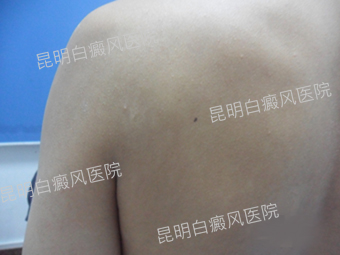   �ᶨ�ֹ��¸ң�սʤ�װ߲�ħ