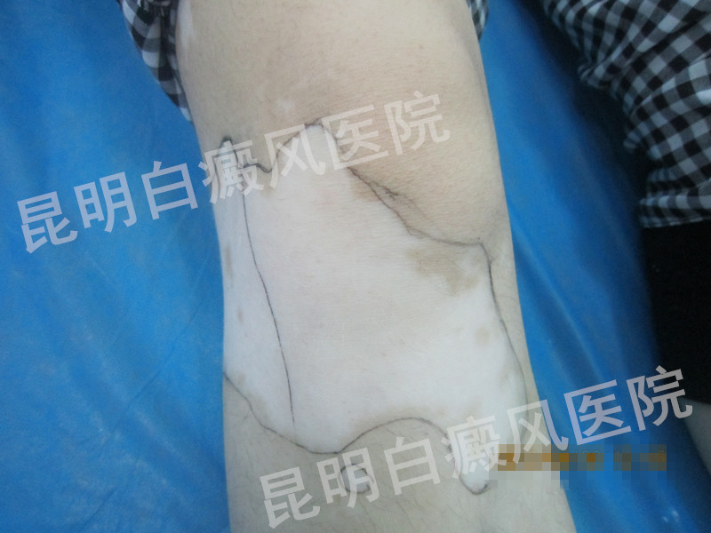 ������˾��� �����������ٻ�