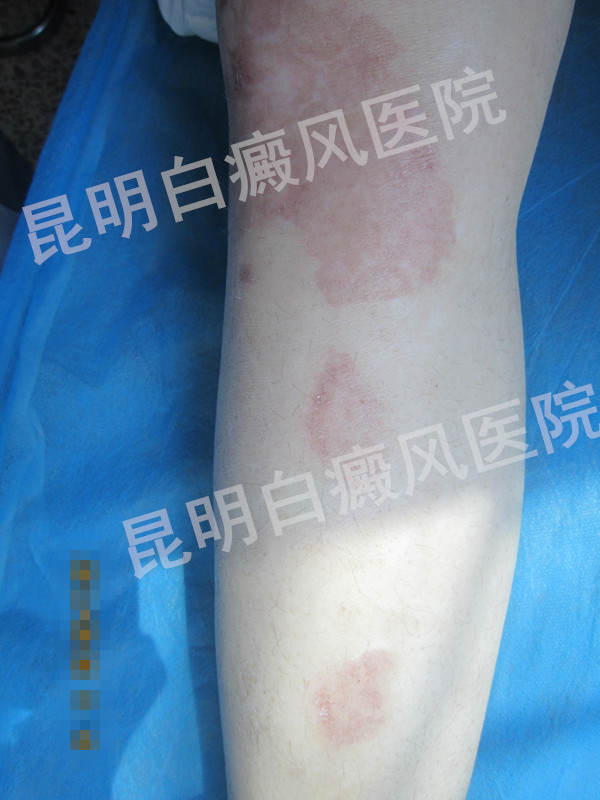 ������˾��� �����������ٻ�