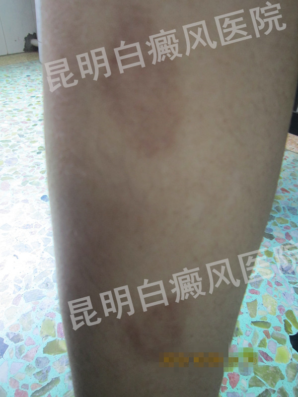 ������˾��� �����������ٻ�