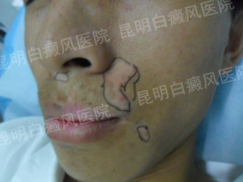 ���ɻӱ���� ���ҿ�������