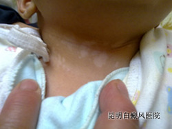 �ٶ�����Ӧ������