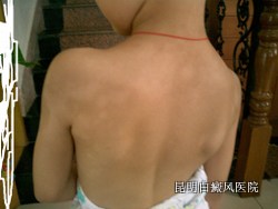 ���緢��ʱ����Щ֢״