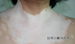 ����ĳ���֢״����