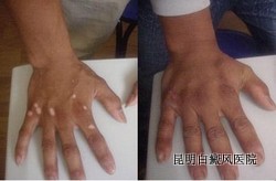 ������ڵ�֢״