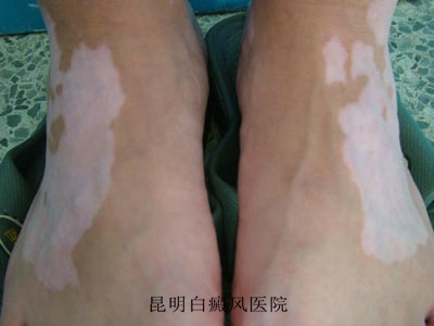 ֫���Ͱ�������Ʒ���