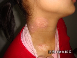 ��չ�ڵİ�����ô��