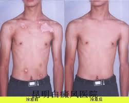 ���������֢״