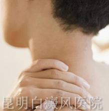 白癜风症状初期