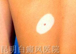 ���粡��ʲô֢״