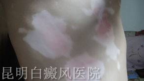 ������͵�֢״��ʲô