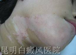 �沿������ô��