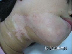 ������ʲô���ĳ���֢״