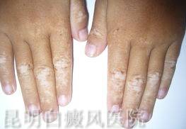 ���ڵİ�����ʲô����