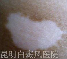 ���緢������Щ֢״