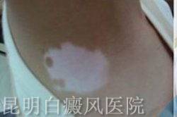 ������ʲô֢״����