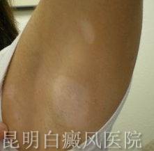 ��������֢״����Щ��