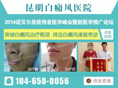 专家解读白癫风的症状表现有哪些?