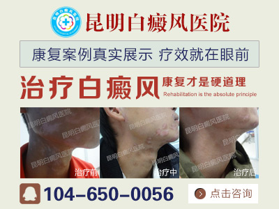 ���ڶ��Ͱ����ǲ��Ƕ������а׷���