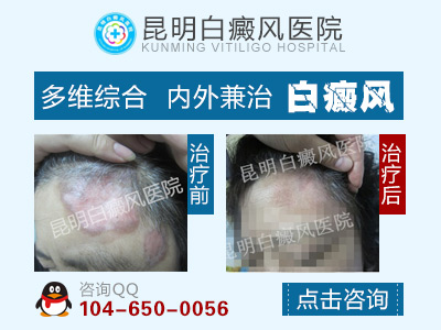 �����˻�������ʲô֢״��