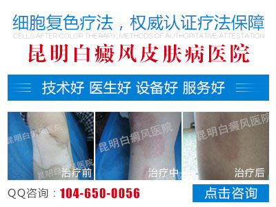 �ٴ��ϰ����֢״����Щ��