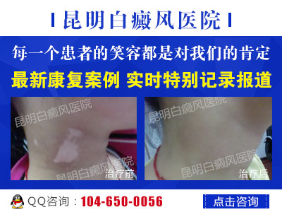 �ð���ľ���֢״����Щ��