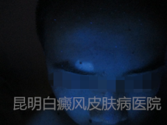 üǰװߣԺ1¿